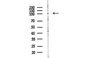 anti-PKD1/2/3/PKC mu (pSer738), (pSer742) antibody