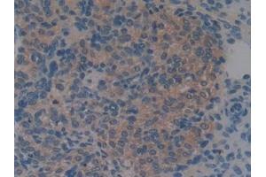 Detection of S100A6 in Mouse Ovary Tissue using Monoclonal Antibody to S100 Calcium Binding Protein A6 (S100A6) (S100A6 anticorps  (AA 1-89))