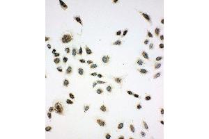 Anti-SIAH Interacting Protein antibody, ICC ICC: A549 Cell