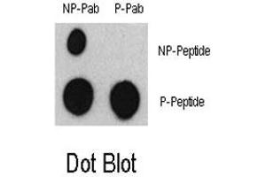 Dot blot analysis of ATF2 (phospho S322) polyclonal antibody  and ATF2 Non Phospho-specific Pab on nitrocellulose membrane.