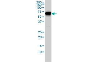 CORO1B monoclonal antibody (M01), clone 1E7 Western Blot analysis of CORO1B expression in Hela S3 NE .