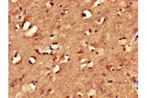 Immunohistochemistry of paraffin-embedded human brain tissue using ABIN7166940 at dilution of 1:100 (MYRIP anticorps  (AA 387-689))