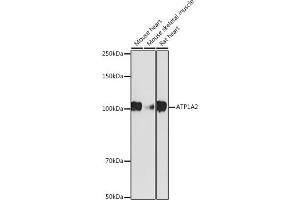 Western blot analysis of extracts of various cell lines, using  antibody (ABIN7265769) at 1:1000 dilution.