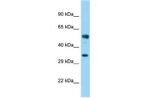 Host: Rabbit Target Name: FAM49B Sample Type: Fetal Brain lysates Antibody Dilution: 1. (FAM49B anticorps  (N-Term))