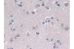 Detection of PSMD2 in Human Cerebrum Tissue using Polyclonal Antibody to Proteasome 26S Subunit, Non ATPase 2 (PSMD2)