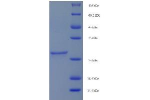 Protein expressed in E. (GHRH Protein (AA 1-44) (His tag))
