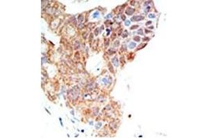 Image no. 2 for anti-Protein Arginine Methyltransferase 5 (PRMT5) (C-Term) antibody (ABIN356529) (PRMT5 anticorps  (C-Term))