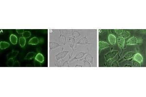 Expression of TROY in human U-87 MG cells - Cell surface detection of TROY in live intact human U-87 MG glioblastoma cells.
