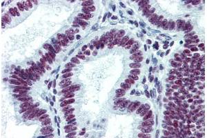 Human Uterus: Formalin-Fixed, Paraffin-Embedded (FFPE) (CDKL1 anticorps  (AA 259-358))