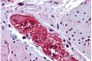 Human Colon, Submucosal Plexus: Formalin-Fixed, Paraffin-Embedded (FFPE) (CABP7 anticorps  (N-Term))