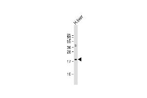 Anti-IFNB1 Antibody (N-term) at 1:2000 dilution + human liver lysate Lysates/proteins at 20 μg per lane. (IFNB1 anticorps  (N-Term))