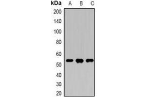 Western blot analysis of DDX39B expression in Hela (A), SKOV3 (B), K562 (C) whole cell lysates. (DDX39B anticorps)