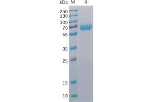 Human CD48 Protein, mFc-His Tag on SDS-PAGE under reducing condition. (CD48 Protein (CD48) (mFc-His Tag))