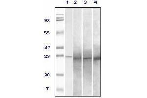 Western Blotting (WB) image for anti-RAB25, Member RAS Oncogene Family (RAB25) antibody (ABIN1108810) (RAB25 anticorps)