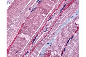 Anti-GRK5 antibody IHC of human skeletal muscle.