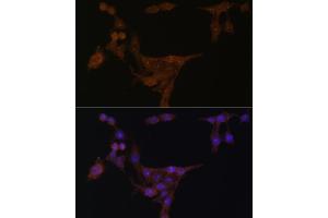 Immunofluorescence analysis of HeLa cells using PPAT Polyclonal Antibody (ABIN6128488, ABIN6146009, ABIN6146010 and ABIN6222409) at dilution of 1:100 (40x lens). (PPAT anticorps  (AA 1-280))