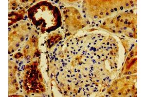 Immunohistochemistry of paraffin-embedded human kidney tissue using ABIN7162672 at dilution of 1:100 (PVALB anticorps  (AA 2-110))