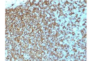 Formalin-fixed, paraffin-embedded human Tonsil stained with HLA-Pan Mouse Recombinant Monoclonal Antibody (rHLA-Pan/3475).