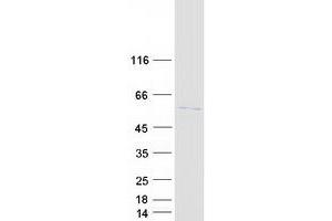 Validation with Western Blot