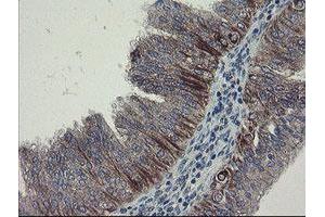 Image no. 3 for anti-Diphthamide Biosynthesis Protein 2 (DPH2) antibody (ABIN1497891)