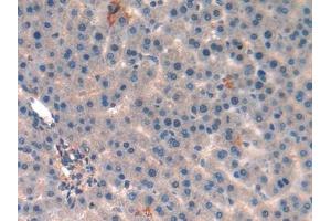 Detection of ND5 in Rat Liver Tissue using Polyclonal Antibody to NADH Dehydrogenase 5 (ND5)