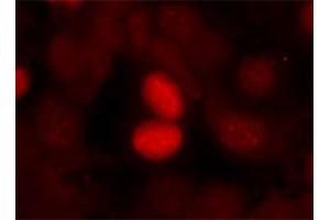 Immunofluorescence staining of manthanol-fixed MCF-7 cells using FOXO1 (phospho S256) polyclonal antibody . (FOXO1 anticorps  (pSer256))