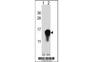 Western blot analysis of CSTA using rabbit polyclonal CSTA Antibody using 293 cell lysates (2 ug/lane) either nontransfected (Lane 1) or transiently transfected (Lane 2) with the CSTA gene.