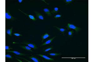 Immunofluorescence of monoclonal antibody to USP47 on HeLa cell. (USP47 anticorps  (AA 203-301))