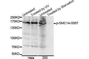 Western Blotting (WB) image for anti-Structural Maintenance of Chromosomes 1A (SMC1A) (pSer957) antibody (ABIN3019554) (SMC1A anticorps  (pSer957))