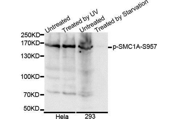 SMC1A antibody  (pSer957)