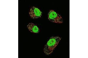 Confocal immunofluorescent analysis of HIF1Alpha Antibody (Center) (ABIN652389 and ABIN2841889) with MDA-M cell followed by Alexa Fluor 488-conjugated goat anti-rabbit lgG (green).