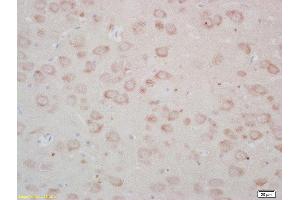 Formalin-fixed and paraffin embedded rat brain labeled with Rabbit Anti-FZD3/Frizzled 3 Polyclonal Antibody, Unconjugated  at 1:200 followed by conjugation to the secondary antibody and DAB staining