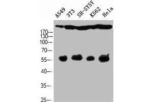 Western Blot analysis of A549 NIH-3T3 SH-SY5Y K562 HELA cells using Cleaved-Notch 4 (V1432) Polyclonal Antibody (NOTCH4 anticorps  (Cleaved-Val1432))