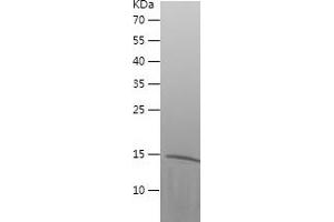 Cystatin C (CST3) (AA 29-146) protein (His tag)
