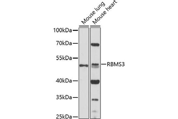 RBMS3 anticorps  (AA 334-433)