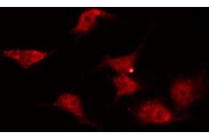 ABIN6272371 staining COLO205 by IF/ICC. (OR2C3 anticorps)