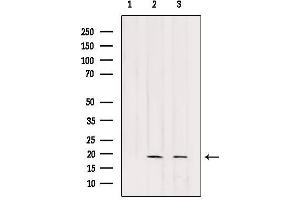Western blot analysis of extracts from various samples, using RPB7 Antibody. (POLR2G anticorps  (Internal Region))