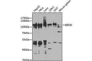 Western blot analysis of extracts of various cell lines, using EEF2K antibody (ABIN6130354, ABIN6139955, ABIN6139956 and ABIN7101771) at 1:1000 dilution. (EEF2K anticorps  (AA 406-725))