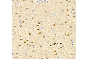 Immunohistochemistry of paraffin embedded rat brain using TCEAL3 (ABIN7075951) at dilution of 1:700 (400x lens)