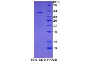 SDS-PAGE analysis of Human VTCN1 Protein.