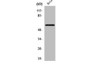 Western Blot analysis of HeLa cells using Smad1/5/9 Polyclonal Antibody