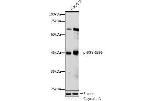 Western blot analysis of extracts of NIH/3T3 cells, using Phospho-IRF3-S396 antibody (ABIN6135244, ABIN6136112, ABIN6136113 and ABIN6225633) at 1:1000 dilution. (IRF3 anticorps  (pSer396))