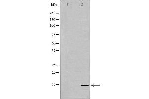 Western blot analysis of A549 whole cell lysates, using PHPT1 Antibody.