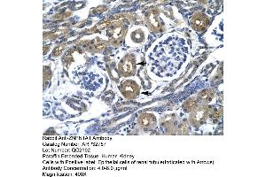 Human kidney (IKZF1 anticorps  (Middle Region))