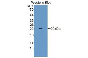 Western blot analysis of recombinant Human PDCD6. (PDCD6 anticorps  (AA 32-191))