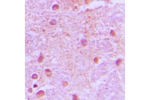 Immunohistochemical analysis of TLE4 staining in human brain formalin fixed paraffin embedded tissue section.