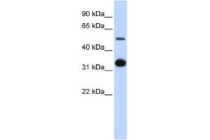 GDF2 antibody used at 1 ug/ml to detect target protein. (GDF2 anticorps  (Middle Region))