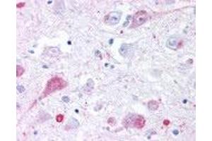 Human Brain, Thalamus (formalin-fixed, paraffin-embedded) stained with GRM2 antibody ABIN213522 at 4 ug/ml followed by biotinylated goat anti-rabbit IgG secondary antibody ABIN481713, alkaline phosphatase-streptavidin and chromogen.