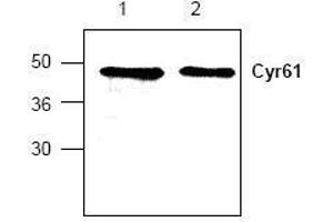 Image no. 1 for anti-Cysteine-Rich, Angiogenic Inducer, 61 (CYR61) antibody (ABIN127279) (CYR61 anticorps)