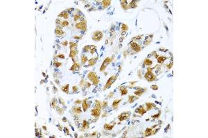Immunohistochemistry of paraffin-embedded human stomach using PIAS3 antibody (ABIN5974247) at dilution of 1/100 (40x lens).